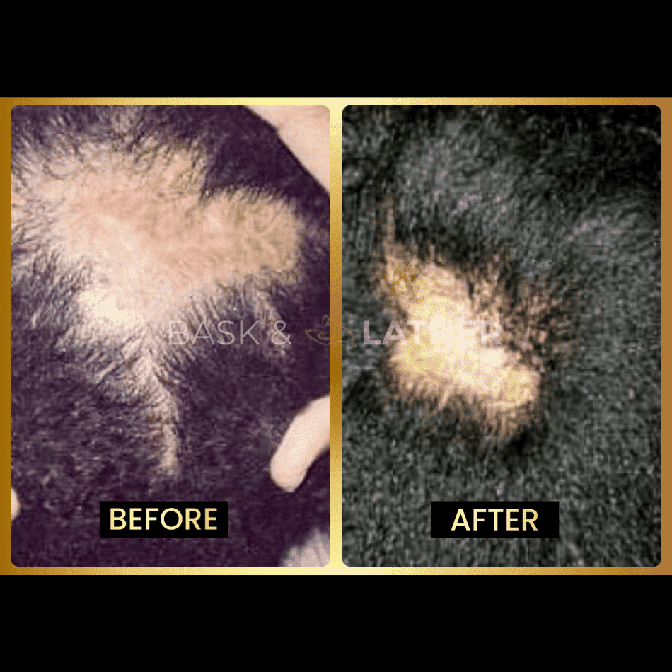 scalp-stimulator-3-month-supply - Bask And Lather Store