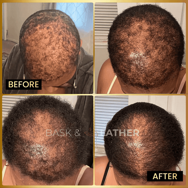 Men's Beard & Hair Growth Bundle