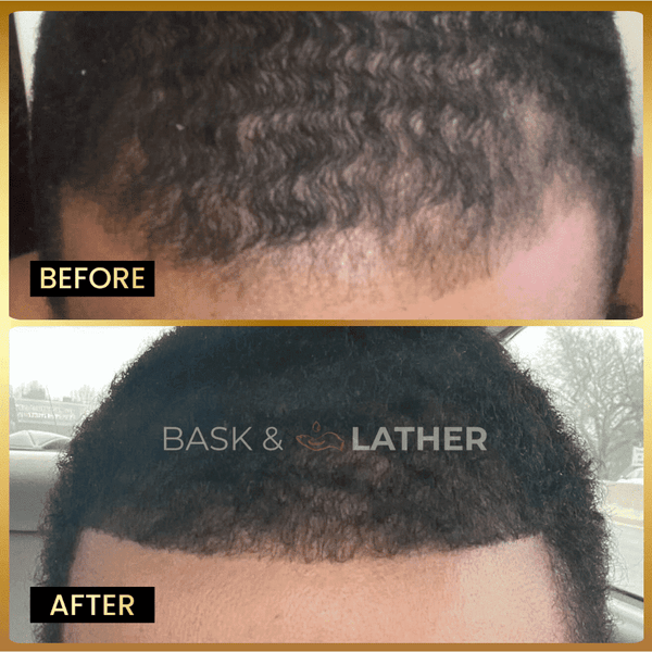 Men's Beard & Hair Growth Bundle