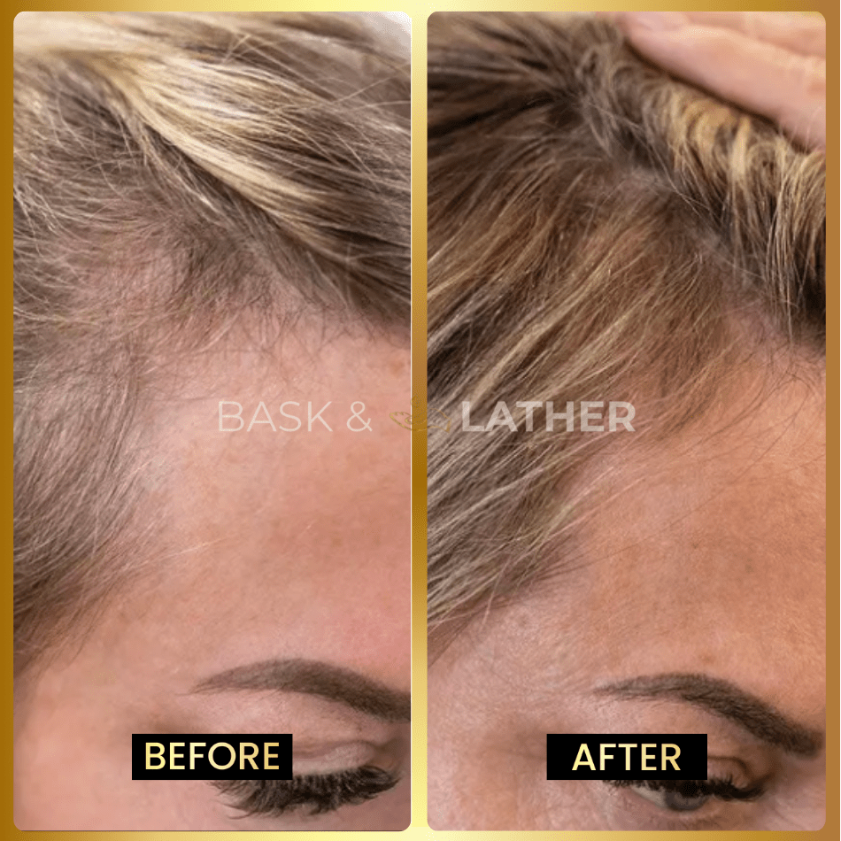 scalp-stimulator-hair-elixir-bundle-growth-length-retention - Bask And Lather Store