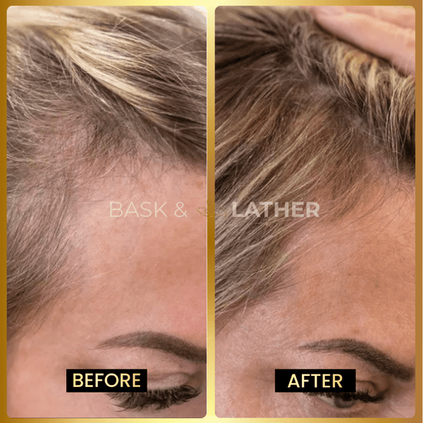 Growth & Length Retention Bundle