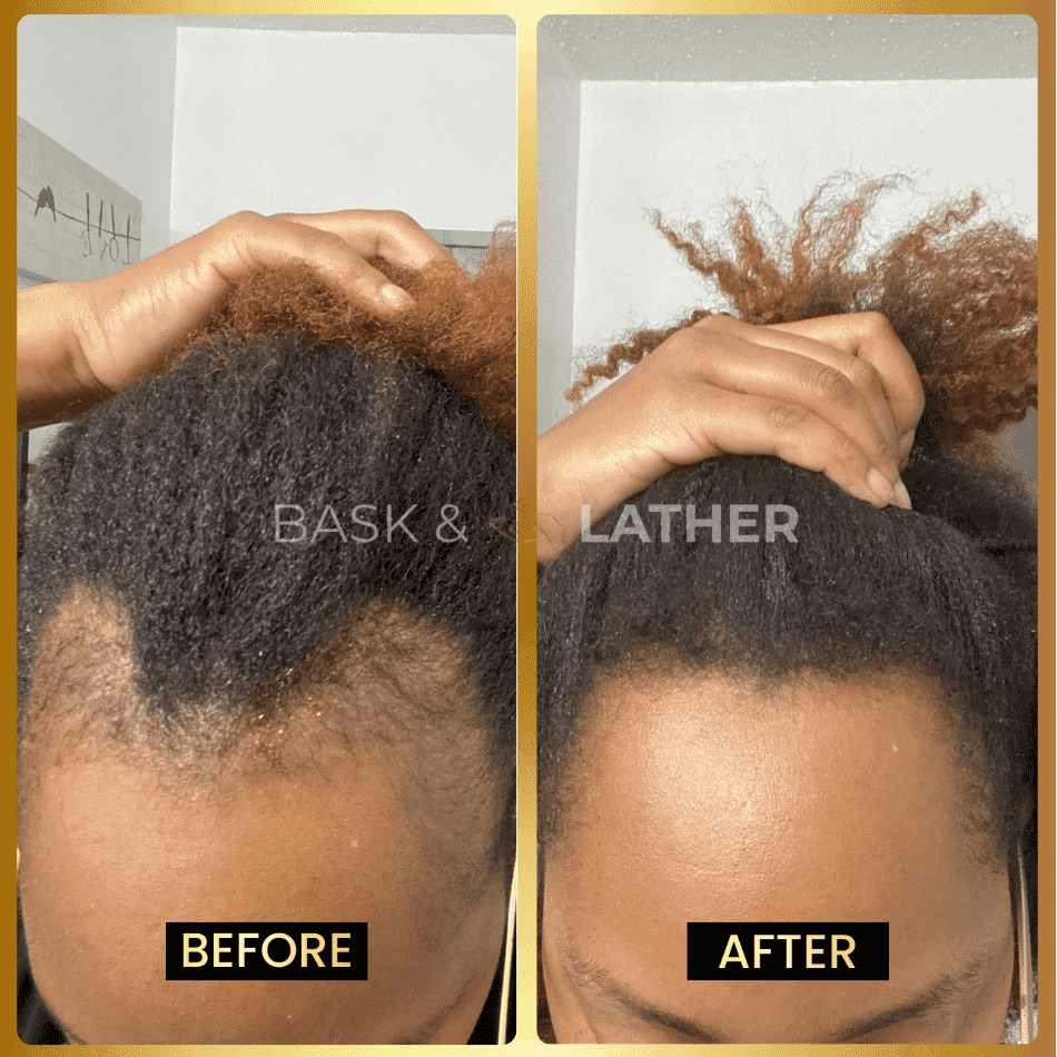 jumbo-scalp-stimulator - Bask And Lather Store