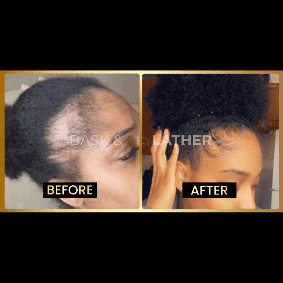 jumbo-scalp-stimulator - Bask And Lather Store