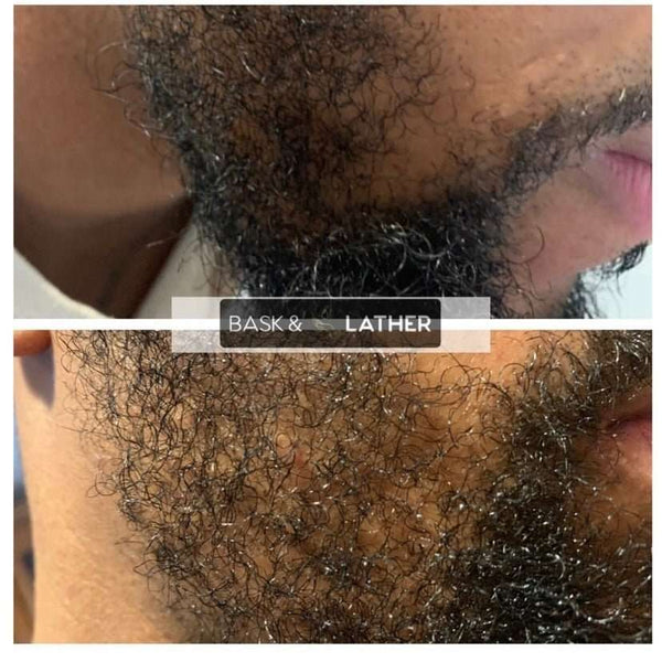 Men's Beard & Hair Growth Bundle