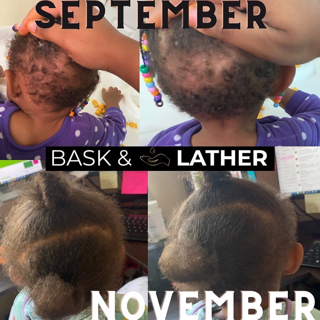 nurture-grow-kids-healthy-hair-bundle - Bask And Lather Store