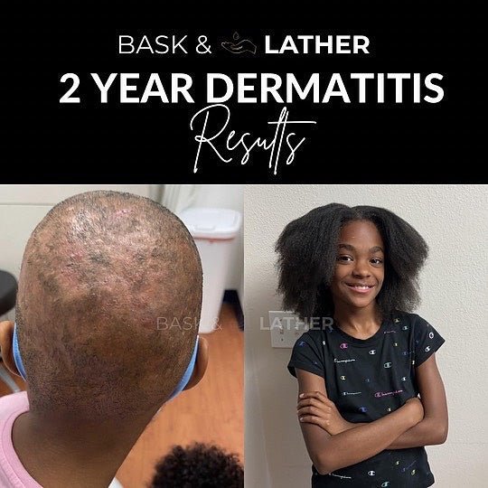 nurture-grow-kids-healthy-hair-bundle - Bask And Lather Store