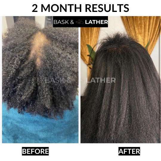 Healthy Hair Starter Kit- Limited Edition